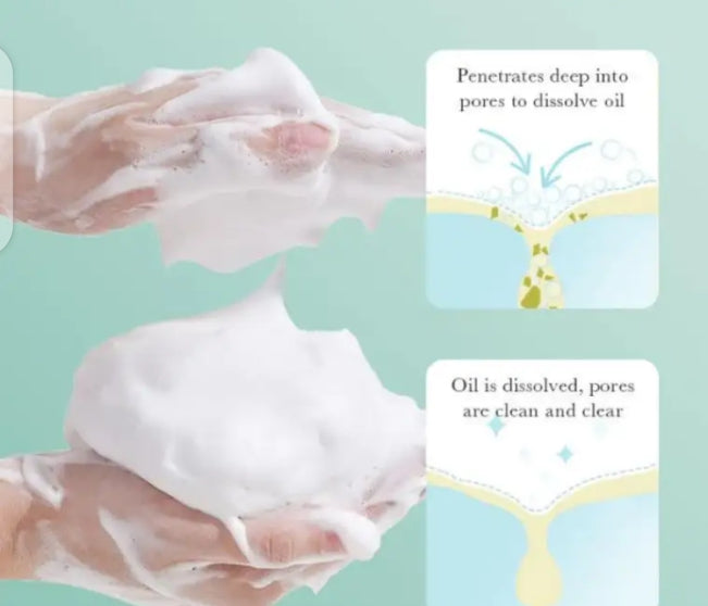 Salicylic acid cleanser 100ml for acne control &oil regulation remove dirt your skin